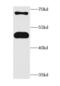 Cartilage Associated Protein antibody, FNab01997, FineTest, Western Blot image 