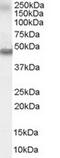 Retinoic Acid Receptor Alpha antibody, TA303003, Origene, Western Blot image 