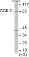 Protein Kinase CGMP-Dependent 2 antibody, EKC1792, Boster Biological Technology, Western Blot image 