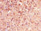 Pleckstrin Homology Like Domain Family B Member 2 antibody, orb47131, Biorbyt, Immunohistochemistry paraffin image 