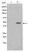 Early Growth Response 2 antibody, TA347615, Origene, Western Blot image 