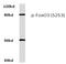 FOXO3A antibody, AP20805PU-N, Origene, Western Blot image 
