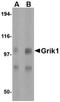 Glutamate Ionotropic Receptor Kainate Type Subunit 1 antibody, orb74907, Biorbyt, Western Blot image 