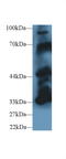 Protein Tyrosine Phosphatase Non-Receptor Type 5 antibody, LS-C663336, Lifespan Biosciences, Western Blot image 