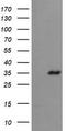 Zinc Finger C2HC-Type Containing 1A antibody, CF505188, Origene, Western Blot image 