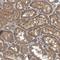 Zinc Finger Protein 79 antibody, NBP1-80872, Novus Biologicals, Immunohistochemistry paraffin image 