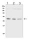 Succinate Dehydrogenase Complex Iron Sulfur Subunit B antibody, M01090-1, Boster Biological Technology, Western Blot image 