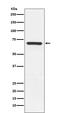 Mitogen-Activated Protein Kinase Kinase Kinase 3 antibody, M03586, Boster Biological Technology, Western Blot image 