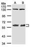 DnaJ homolog subfamily C member 7 antibody, orb69737, Biorbyt, Western Blot image 