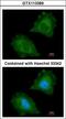 Aspartoacylase antibody, LS-B10894, Lifespan Biosciences, Immunocytochemistry image 