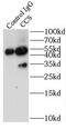 Copper chaperone for superoxide dismutase antibody, FNab01395, FineTest, Immunoprecipitation image 