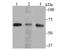 Ran GTPase Activating Protein 1 antibody, NBP2-76865, Novus Biologicals, Western Blot image 