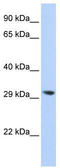 Lysophospholipase 2 antibody, TA344253, Origene, Western Blot image 