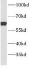 Bardet-Biedl Syndrome 9 antibody, FNab00825, FineTest, Western Blot image 