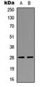 Neural Proliferation, Differentiation And Control 1 antibody, orb256725, Biorbyt, Western Blot image 