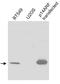 CDKN2A antibody, GTX30433, GeneTex, Western Blot image 