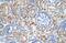 Armadillo Repeat Containing X-Linked 6 antibody, GTX46680, GeneTex, Immunohistochemistry paraffin image 