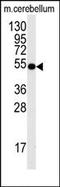 Cell Division Cycle 25A antibody, AP13256PU-N, Origene, Western Blot image 