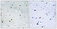 DEAD-Box Helicase 24 antibody, abx014236, Abbexa, Western Blot image 