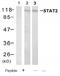 P113 antibody, AP08100PU-N, Origene, Western Blot image 