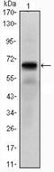 Parathyroid Hormone 1 Receptor antibody, NBP1-51640, Novus Biologicals, Western Blot image 