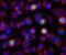Aurora Kinase B antibody, M00246-3, Boster Biological Technology, Immunohistochemistry paraffin image 