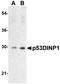 Tumor Protein P53 Inducible Nuclear Protein 1 antibody, NBP1-76638, Novus Biologicals, Western Blot image 
