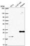 CCAAT Enhancer Binding Protein Beta antibody, HPA061355, Atlas Antibodies, Western Blot image 