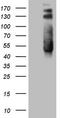 Twinfilin Actin Binding Protein 1 antibody, TA808935S, Origene, Western Blot image 