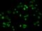 Tumor Associated Calcium Signal Transducer 2 antibody, 10428-R020, Sino Biological, Immunohistochemistry paraffin image 