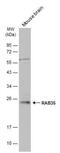 Ras-related protein Rab-35 antibody, NBP2-20042, Novus Biologicals, Western Blot image 
