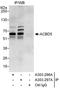Acyl-CoA Binding Domain Containing 5 antibody, A303-296A, Bethyl Labs, Immunoprecipitation image 