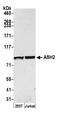 SET1 antibody, A300-107A, Bethyl Labs, Western Blot image 