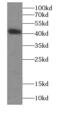 Dystroglycan 1 antibody, FNab02596, FineTest, Western Blot image 