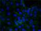 Junction Plakoglobin antibody, GTX11506, GeneTex, Immunofluorescence image 
