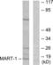 Melan-A antibody, LS-C118512, Lifespan Biosciences, Western Blot image 