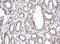 Alpha-1,4-N-Acetylglucosaminyltransferase antibody, M13668, Boster Biological Technology, Immunohistochemistry paraffin image 