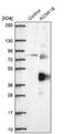 Potassium Two Pore Domain Channel Subfamily K Member 18 antibody, NBP1-81570, Novus Biologicals, Western Blot image 