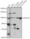 DNA Methyltransferase 3 Beta antibody, LS-C746877, Lifespan Biosciences, Western Blot image 