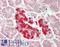 SERPINB2 antibody, LS-B13565, Lifespan Biosciences, Immunohistochemistry paraffin image 