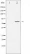 Checkpoint Kinase 1 antibody, TA325370, Origene, Western Blot image 