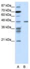 Proteasome 26S Subunit, ATPase 2 antibody, TA335805, Origene, Western Blot image 