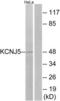 G protein-activated inward rectifier potassium channel 4 antibody, LS-C120664, Lifespan Biosciences, Western Blot image 