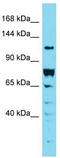 DENN Domain Containing 2A antibody, TA335582, Origene, Western Blot image 