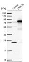Zinc Finger HIT-Type Containing 6 antibody, PA5-53736, Invitrogen Antibodies, Western Blot image 