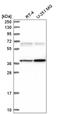Calcium/Calmodulin Dependent Protein Kinase II Gamma antibody, HPA040656, Atlas Antibodies, Western Blot image 