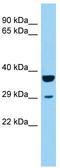 Potassium Channel Tetramerization Domain Containing 1 antibody, TA331513, Origene, Western Blot image 