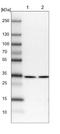 Sideroflexin 1 antibody, NBP1-83708, Novus Biologicals, Western Blot image 