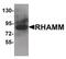 HMMR antibody, PA5-21105, Invitrogen Antibodies, Western Blot image 