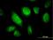Rho-related GTP-binding protein RhoQ antibody, H00023433-B01P, Novus Biologicals, Immunocytochemistry image 